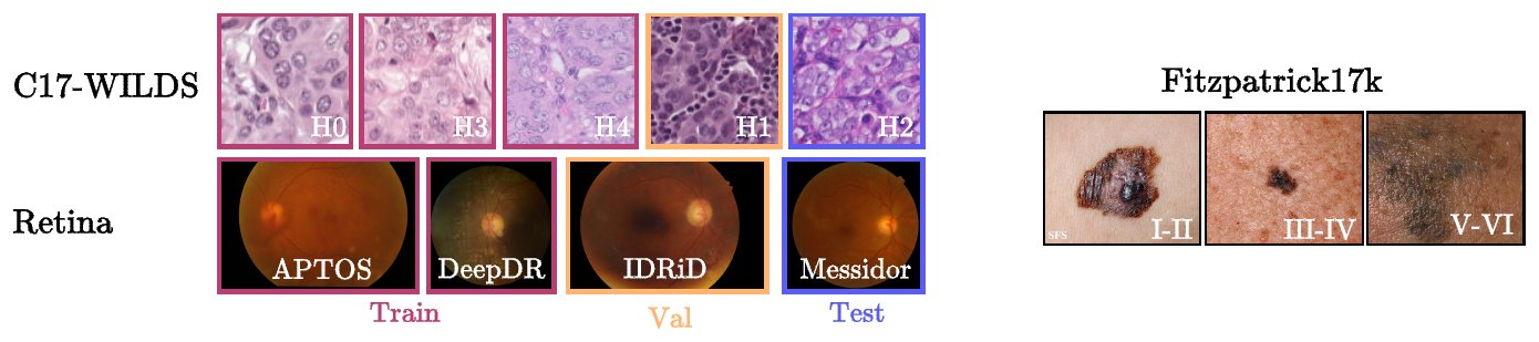 Domain shifts across hospitals (histopathology), fundus cameras (retina) and skin tones (dermatology)